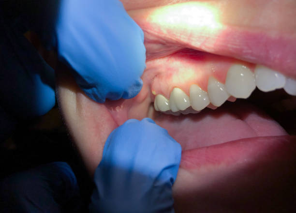  Montgomery, WV Emergency Dentist Pros